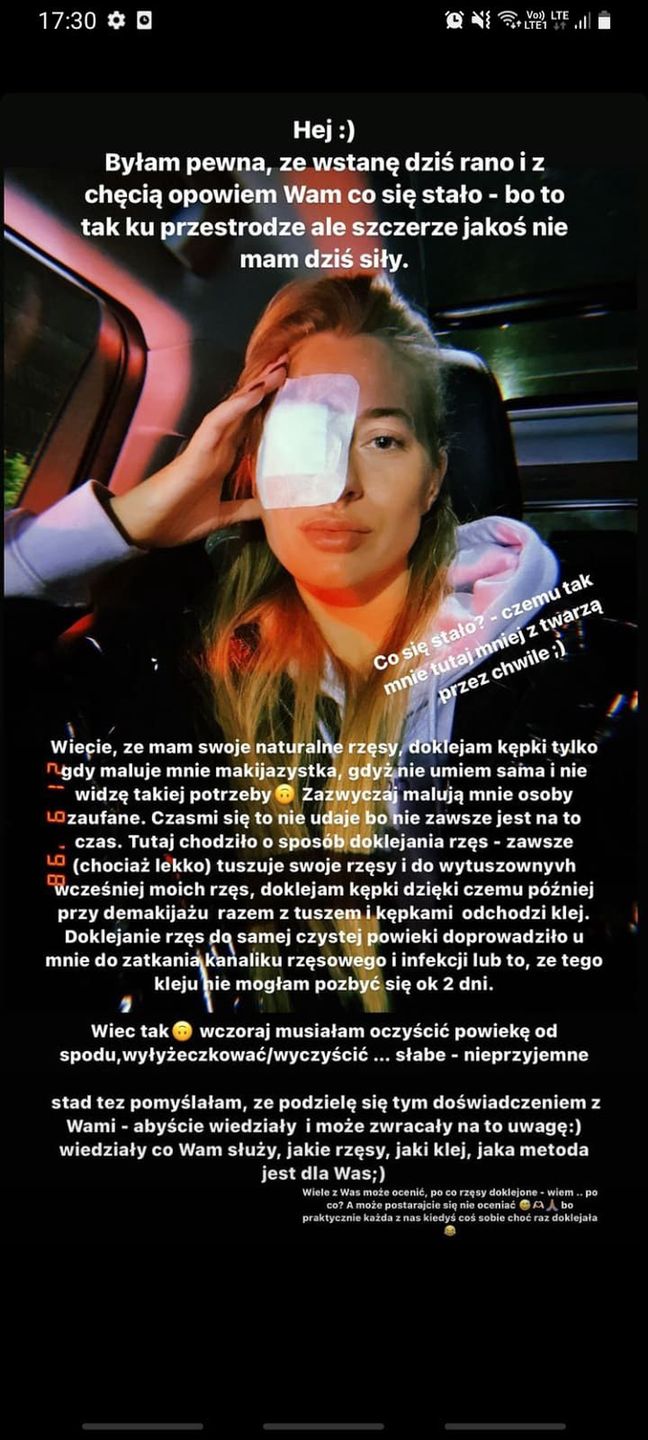 Marcelina Zawadzka miała infekcję oka przez niewłaściwie doklejone rzęsy