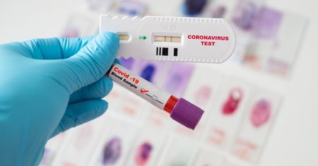Ukraina. Biura podróży wystawiają podrobione wyniki testu na koronawirusa