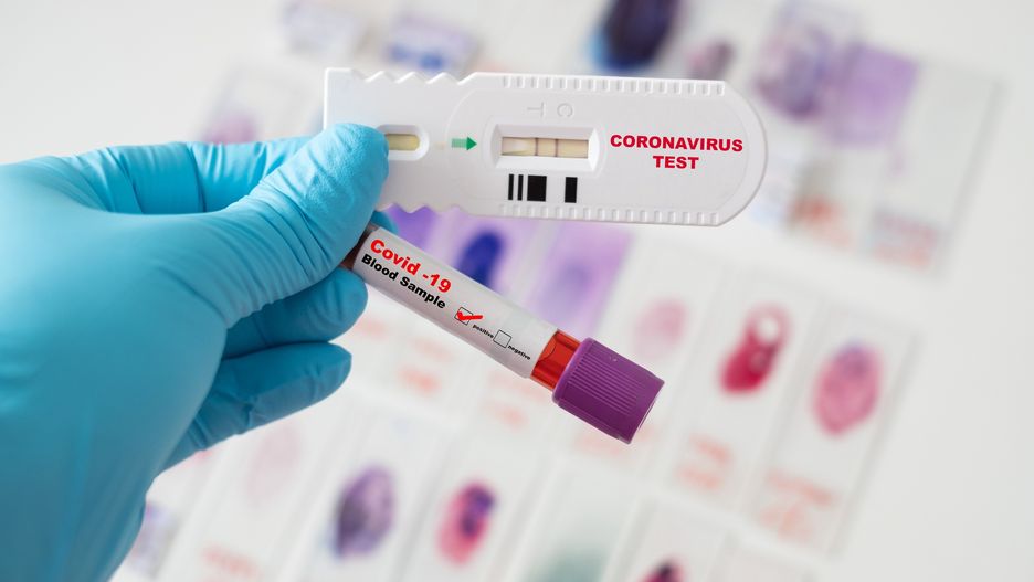 Test na obecność koronawirusa - zdjęcie poglądowe