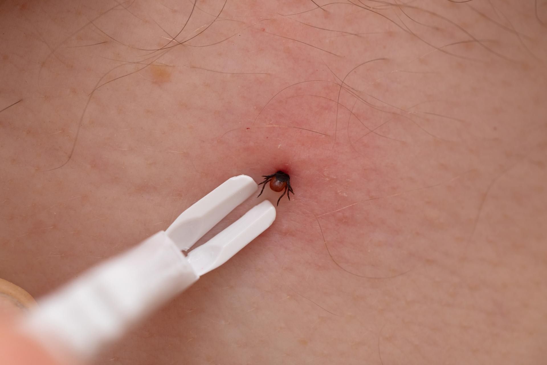 Oz jest wirusem przenoszonym przez kleszcze i został odkryty w północno-zachodniej części Japonii