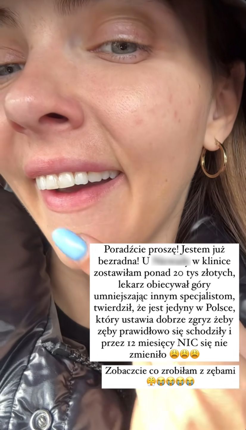 Marcela Leszczak rozpacza nad swoimi zębami. Wydała już krocie