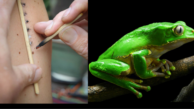 Ceremonia Kambo przy użyciu jadu amazońskiej żaby