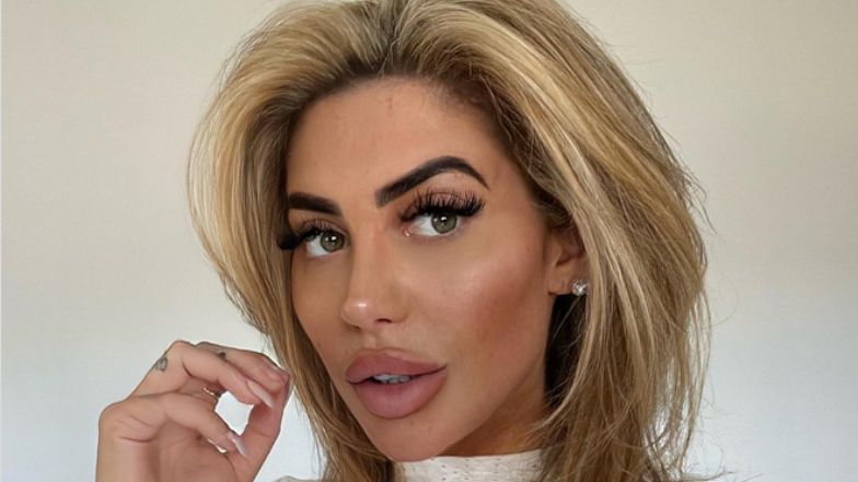 Brytyjska celebrytka oszpecona po nieudanym zabiegu