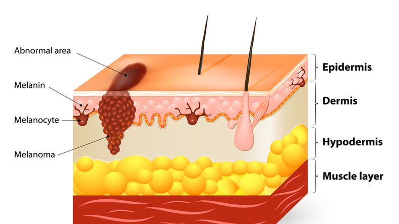 Melanocyty to komórki pigmentowe, które odpowiadają za tworzenie barwników w naszym organizmie.
