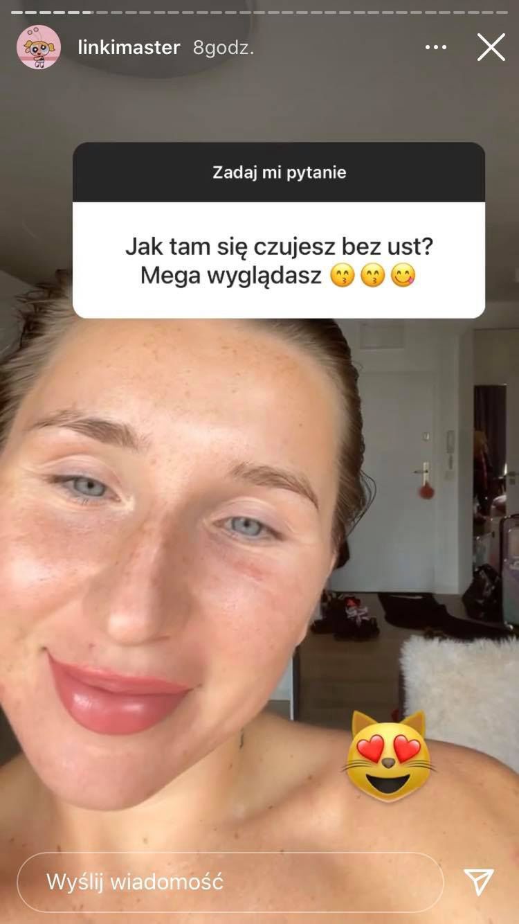 Marta Linkiewicz rozpuściła kwas w ustach i czuje się teraz naturalnie