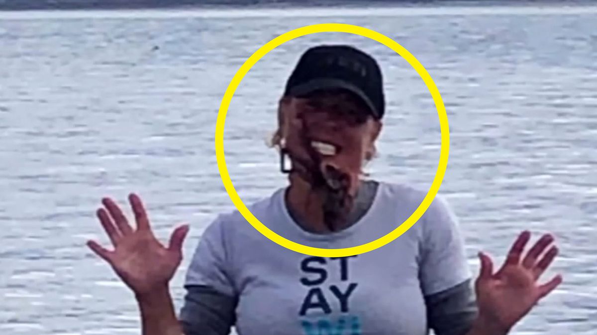 USA: Ugryzła ją trująca ośmiornica, gdy robiła zdjęcie na konkurs 1