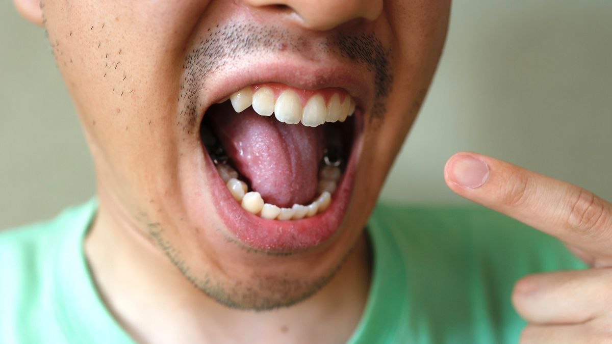 Cukrzycę można zauważyć w jamie ustnej
