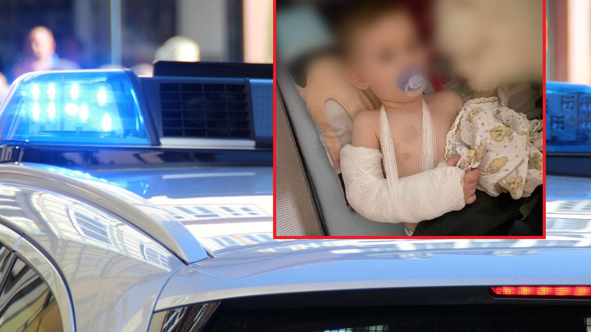 Dwulatek został pobity przez partnera matki.