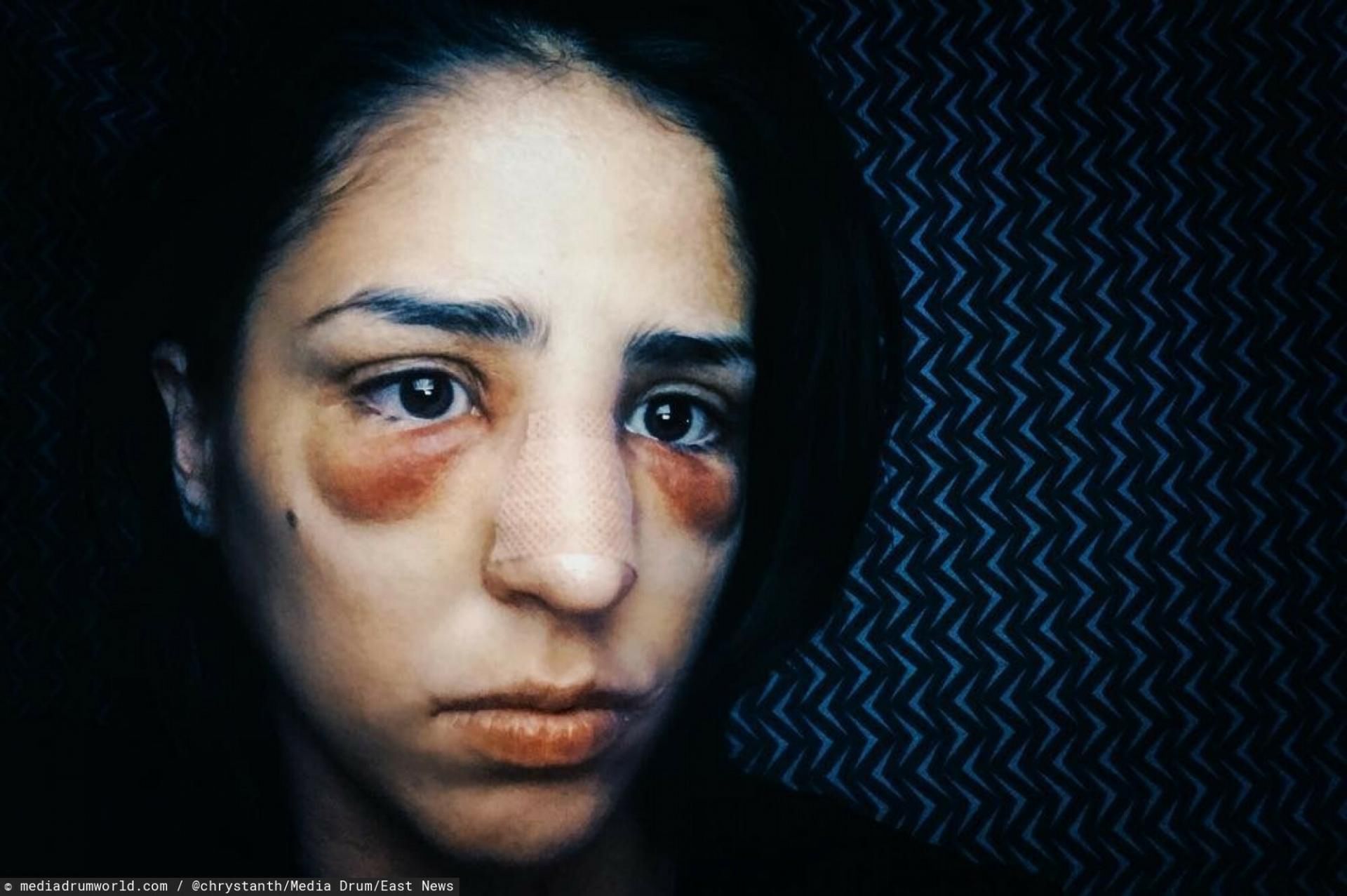 Christian doznała ciężkiej reakcji alergicznej na leki