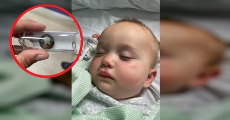 Matka myślała, ze to ogórek. Dziecko miało dziurę w gardle