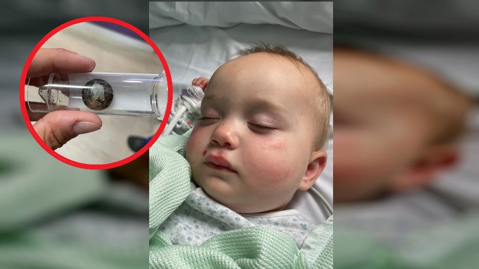 Dziecko połknęło baterię. W przełyku zrobiła się dziura