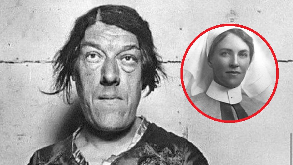 Mary Ann Bevan cierpiała na rzadką chorobę