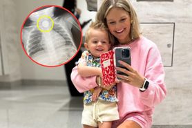 1,5-roczny chłopiec połknął baterię. Tygodniami walczył o życie