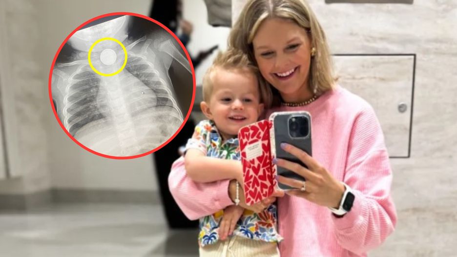 Połknięcie baterii jest niezwykle groźne