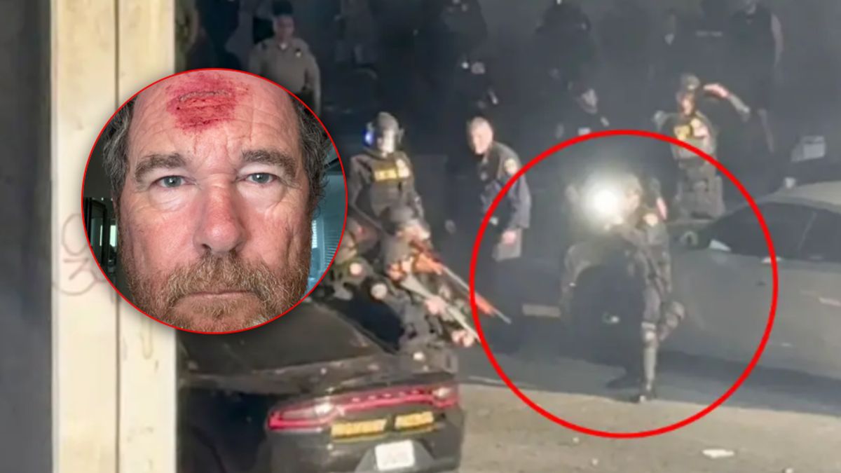 Toby Canham postrzelony w LA.