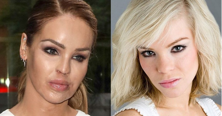 Modelka oblana kwasem pokazała DRASTYCZNE ZDJĘCIE wykonane zaraz po wypadku (FOTO)