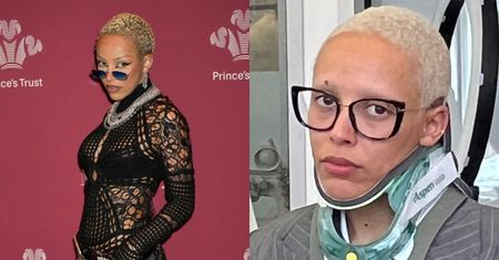 Brat Doji Cat WYBIŁ JEJ ZĘBA. Matka wniosła do sądu o zakaz zbliżania się: "Zaatakował ją w bardzo poniżający sposób"
