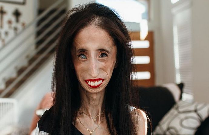 Lizzie zaakceptowała siebie