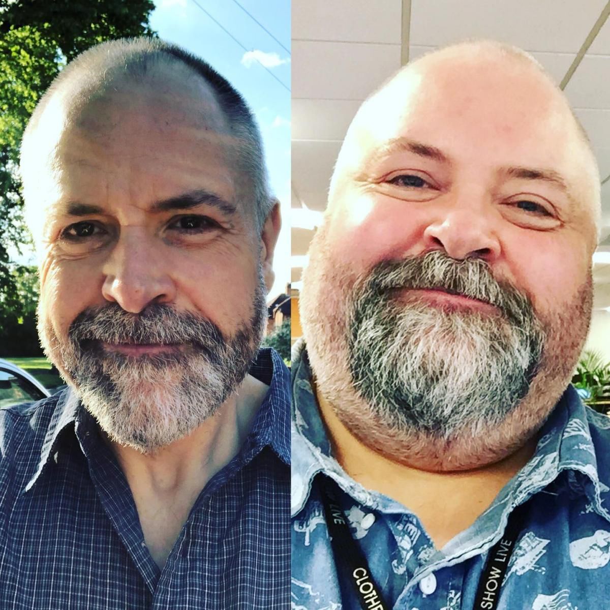 Dave cierpiał na cukrzycę typu 2 i kilka innych schorzeń