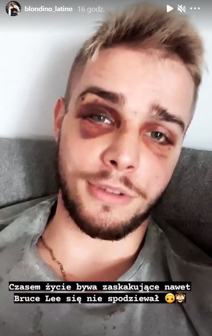 Blondino z "Hotelu Paradise" został pobity i okradziony