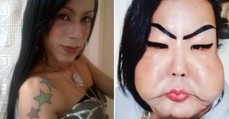 Juju Oliveira chciała poprawić wygląd twarzy. W jej policzki wstrzyknięto silikon