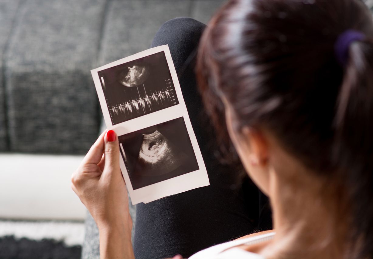 Wiele kobiet nie radzi sobie psychicznie z cierpieniem po utracie dziecka. 