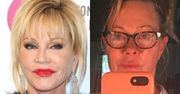 Melanie Griffith walczy z nowotworem skóry: "To ostatni krok, aby wyleczyć raka"
