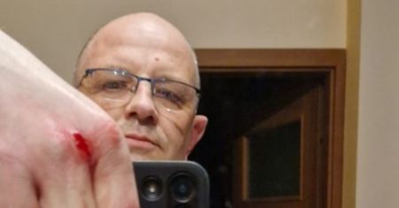 "Biegł prosto na mnie". Radny PiS pokazał zdjęcia obrażeń