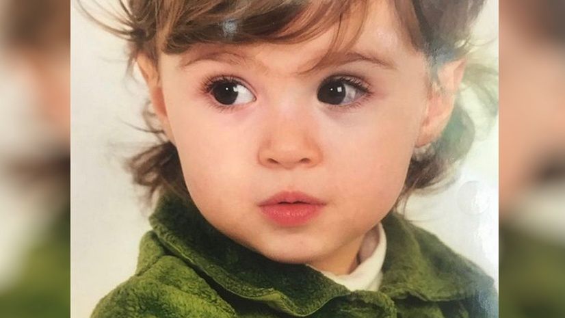 W dzieciństwie malowała się, by ukryć znamię. Dzisiaj zachęca do samoakceptacji