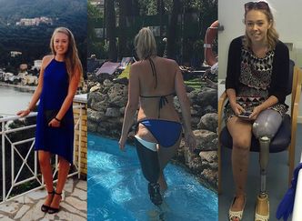 19-latka, która straciła nogę w wypadku pokazała się w bikini. "Zaczynam się czuć dobrze we własnym ciele" (ZDJĘCIA)