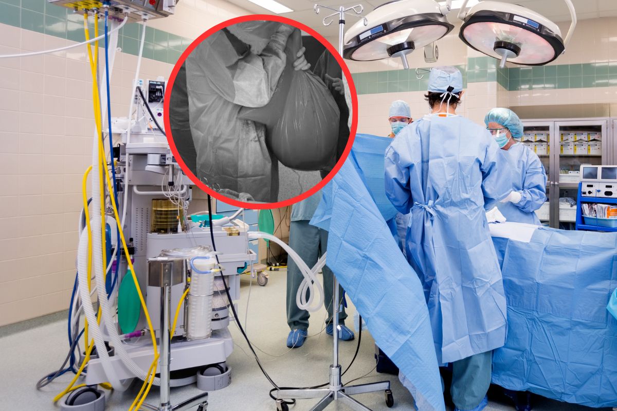 Lekarze z Iławy usunęli pacjentce monstrualnego guza / zdjęcie poglądowe