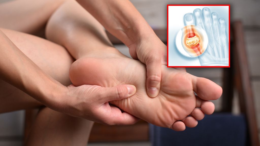 Dna moczanowa rozwija się wtedy, gdy we krwi utrzymuje się zbyt wysokie stężenie kwasu moczowego