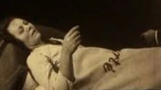 Tajemnicza choroba sprzed wieku. Zabiła 500 tys. osób i zniknęła