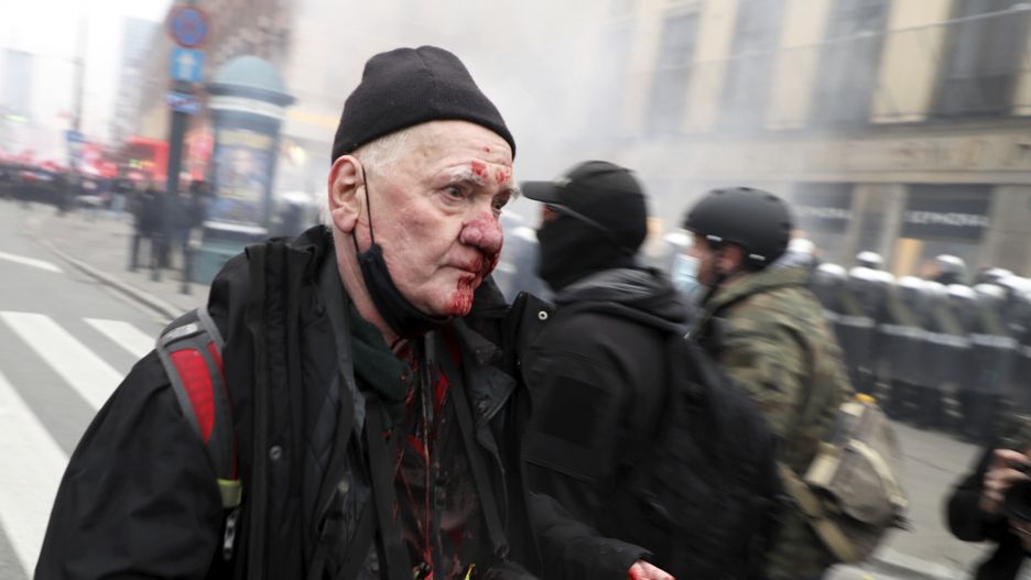 Fotoreporter Tomasz Gutry postrzelony w Dzień Niepodległości. Szef KSP chce wyjaśnienia sprawy