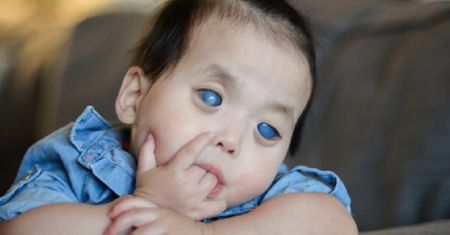 Matka zrzekła się praw rodzicielskich po porodzie. Dziewczynka o srebrnych oczach trafiła do adopcji