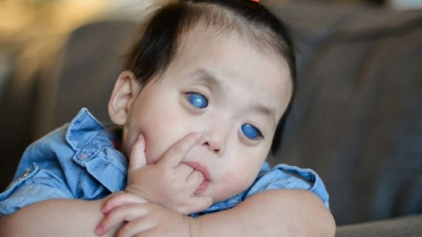 Co nowego u dziecka o srebrnych oczach?