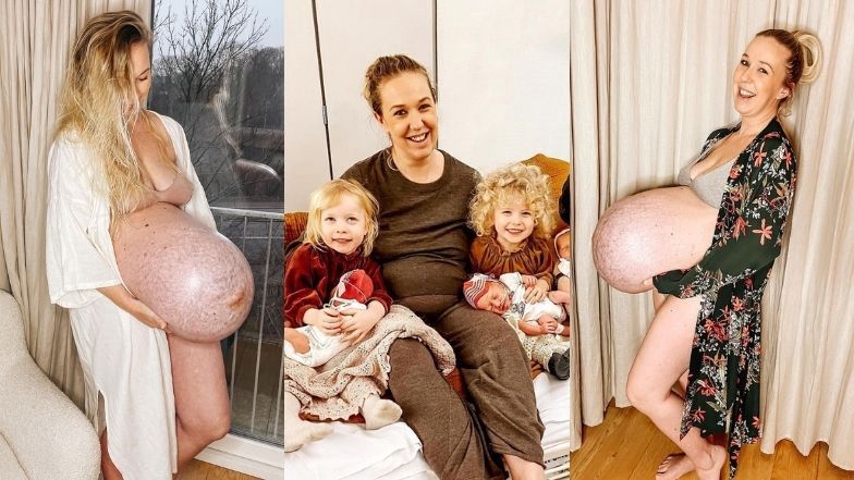 Duńska influecnerka Michella Meier-Morsi urodziła trojaczki, szokując przy okazji zdjęciami ogromnego ciążowego brzucha