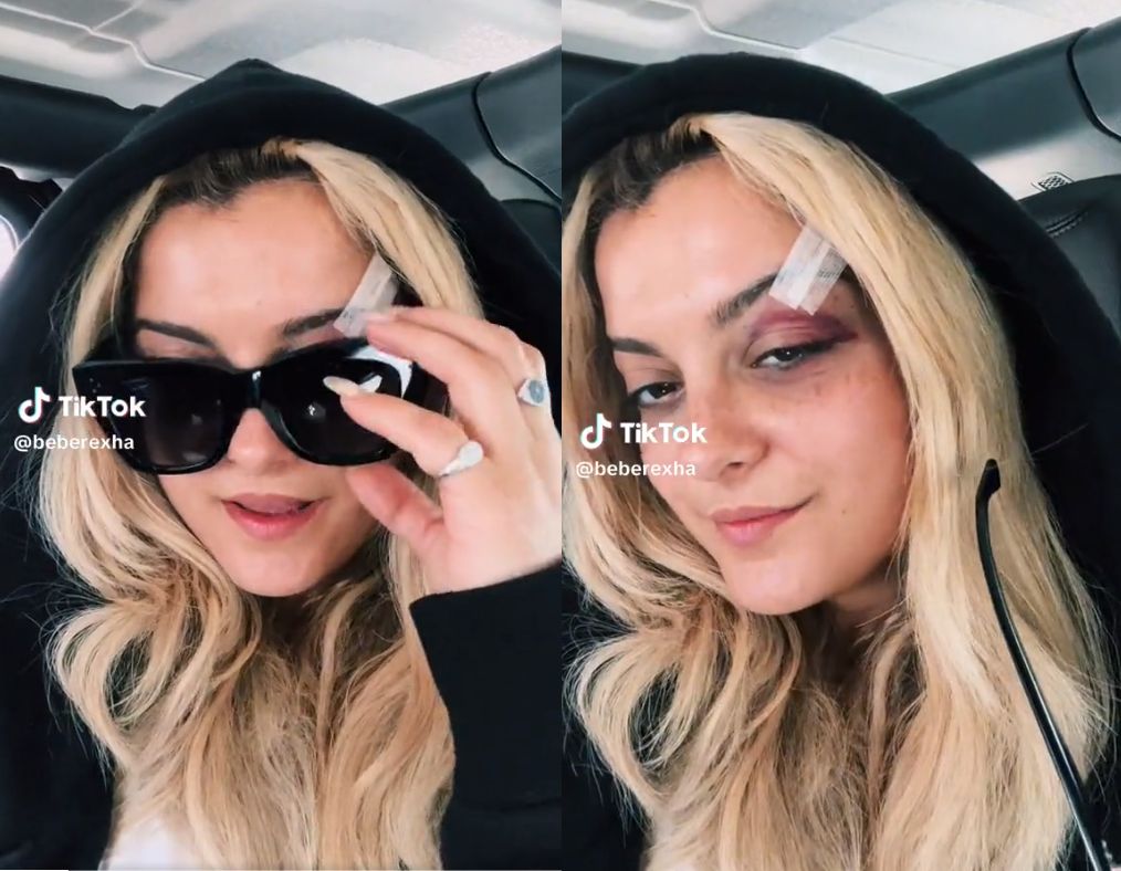 Bebe Rexha po interwencji lekarzy
