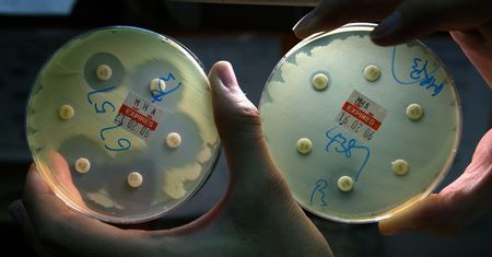 "Żywy czujnik" wykryje mikroplastik. Wystarczyły dwa geny