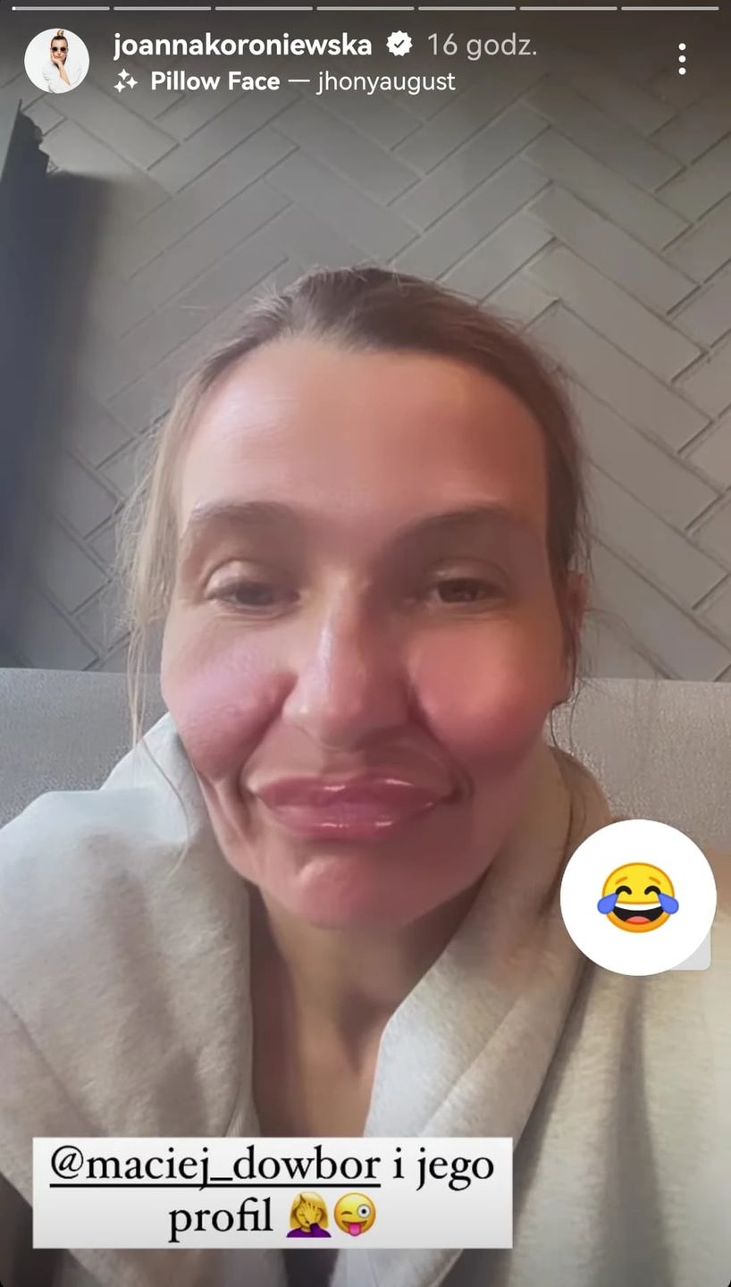 Joanna Koroniewska pokazała monstrualne usta