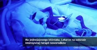 Amerykanka urodziła tylko jedno ze swoich bliźniąt