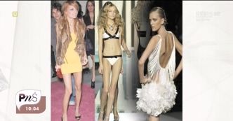 Bulimia - problem, który dotyka też gwiazdy