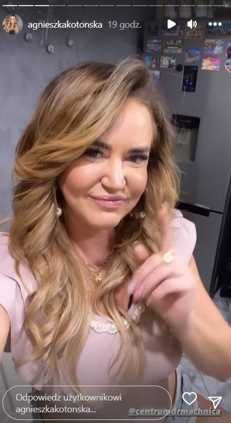 Agnieszka Kotońska pokazała twarz po zabiegu