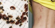 Jak pozbyć się pluskiew? Oto 10 naturalnych sposobów