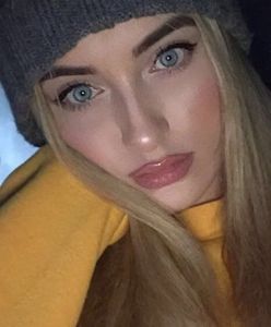 Irlandia: 23-latka straciła nogę. Bez amputacji by umarła