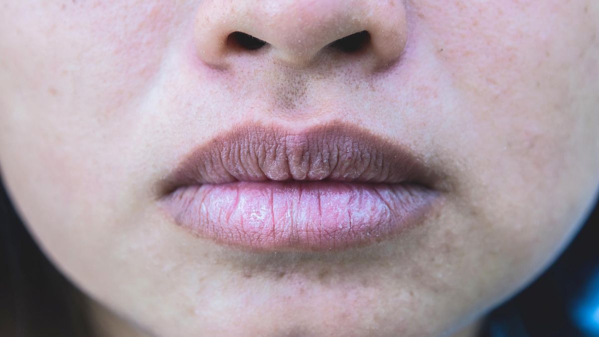 Sine usta, skóra i paznokcie mogą być objawem COVID-19