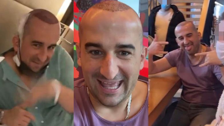 Przeszczep włosów Miśka Koterskiego