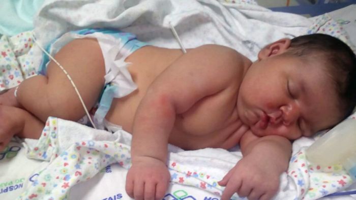 Myślała, że jest w ciąży z bliźniakami. Okazało się, że urodzi bardzo duże dziecko