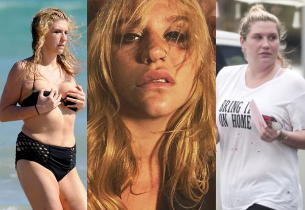 Kesha o anoreksji i bulimii: "W najgorszych momentach mojego życia słyszałam, że najlepiej wyglądam"