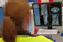 Na lotnisku Chopina zatrzymano kobietę. W żołądku narkotyki, są zdjęcia